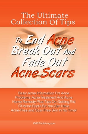 The Ultimate Collection Of Tips To End Acne Break Out And Fade Out Acne Scars Basic Acne Information For Acne Problems, Acne Treatment And Acne Home Remedy Plus Tips On Getting Rid Of Acne Scars So You Can Have Acne-Free and Scar-Free Sk【電子書籍】