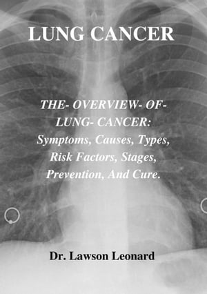 LUNG CANCER