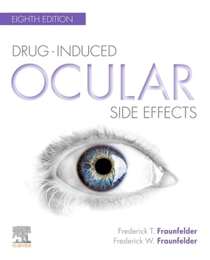 Drug-Induced Ocular Side Effects: Clinical Ocular Toxicology E-Book