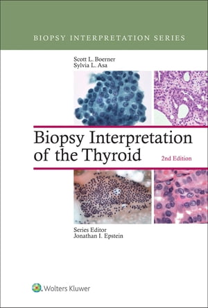 Biopsy Interpretation of the Thyroid