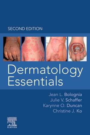 Dermatology Essentials - E-Book