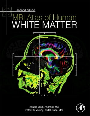 MRI Atlas of Human White Matter