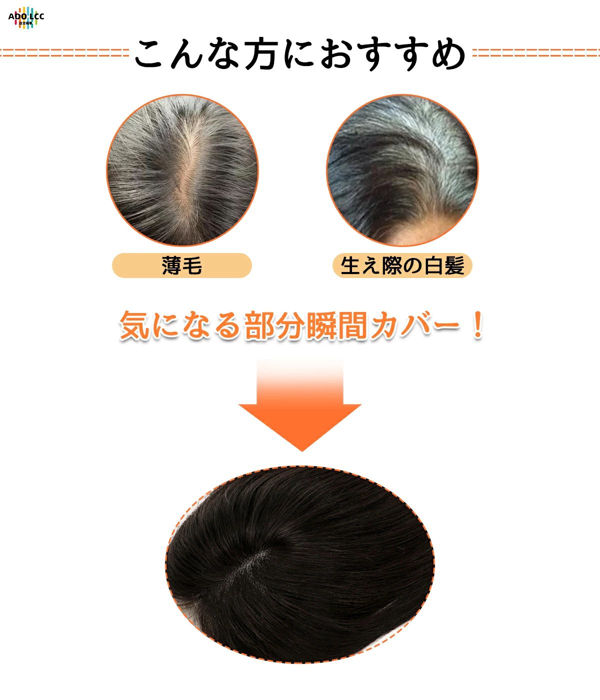 �����å� ��ʬ���Ĥ� ����100�� �ܥ�塼�ॢ�å� ʬ���� ���ӱ��� �Ĥ��� ��ȱ ���� ���ĥ� �����å� �ݥ���ȥ����å� ������ʬ���Ĥ�