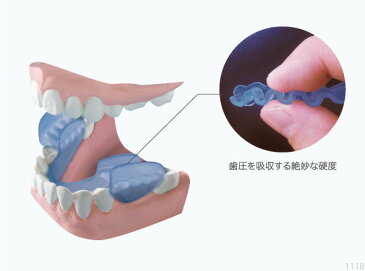 歯ぎしりピタリ ストロング マウスピース 頭痛 肩こり 噛み合わせ 食いしばり ドリーム 0070-2667【ポイント10倍】【送料無料】