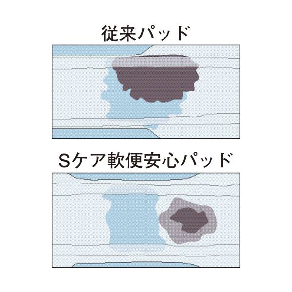 （まとめ）大王製紙 アテント Sケア軟便安心パッド 1パック（20枚）【×2セット】 (代引不可)