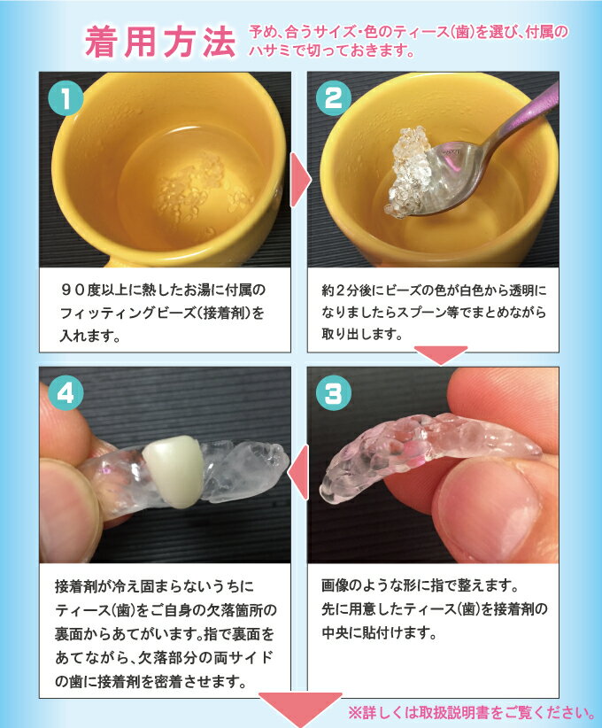 インスタントスマイル テンポラリートゥース リプレールメントキット 部分抜け歯 写真撮影 記念撮影 義歯 仮歯 悩み サポート(代引不可)【送料無料】