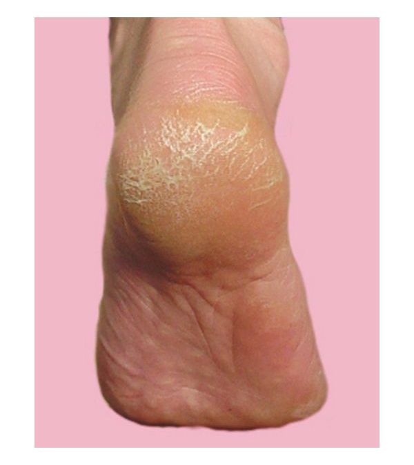 ������� ���������䤫�����ѥ��꡼�� 110g