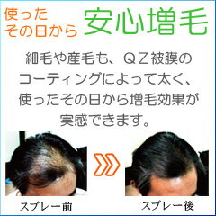 超耐水増毛スプレー 増毛剤『QZジェントリー(180ml)3本セット』■細毛・薄毛対策に！まるで植毛のように自毛が増やせる！累計販売45万人突破の大人気増毛スプレー【薄毛隠し 薄毛対策 薄毛かくし 円形脱毛症隠し 増毛ふりかけ 生え際 AGA】 2