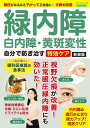 ●取寄品●緑内障・白内障・黄斑変性 自分で防ぎ治す特効ケア 新装版/早期に発見し適切なケア/クラフト手芸本ブティック社