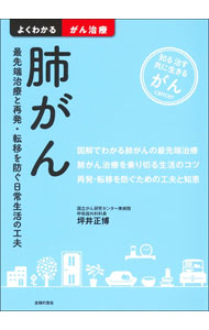 【中古】肺がん / 坪井正博