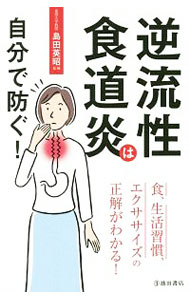 【中古】逆流性食道炎は自分で防ぐ！ / 島田英昭（消化器外科学） (新書)