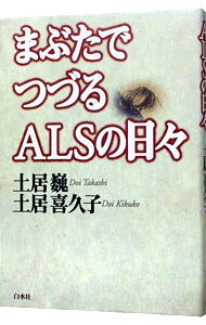 &nbsp;&nbsp;&nbsp; まぶたでつづるALSの日々 単行本 の詳細 カテゴリ: 中古本 ジャンル: スポーツ・健康・医療 医療 出版社: 白水社 レーベル: 作者: 土居喜久子 カナ: マブタデツズルエーエルエスノヒビ / ドイキクコ サイズ: 単行本 ISBN: 456004953X 発売日: 1998/04/01 関連商品リンク : 土居喜久子 白水社　
