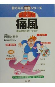 &nbsp;&nbsp;&nbsp; 徹底図解痛風 単行本 の詳細 カテゴリ: 中古本 ジャンル: スポーツ・健康・医療 医療 出版社: 法研 レーベル: 目でみる医書シリーズ 作者: 西岡久寿樹 カナ: テッテイズカイツウフウ / ニシオカクスキ サイズ: 単行本 ISBN: 4879543276 発売日: 2000/02/01 関連商品リンク : 西岡久寿樹 法研 目でみる医書シリーズ　