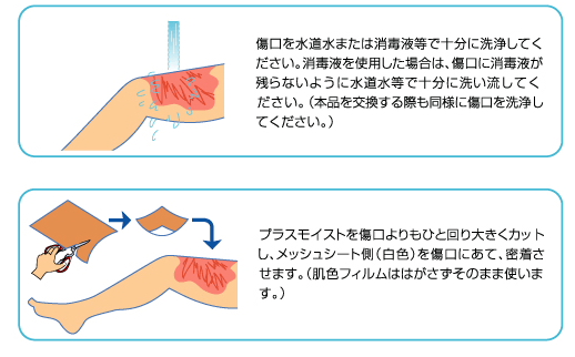 プラスモイスト[熱傷・手術用被覆保護材]VA1...の紹介画像2