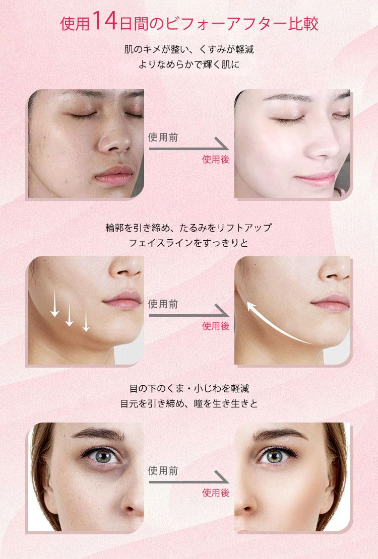 美顔器 ems 美容家電 リフトアップ 美容 冷却・温熱 美容デバイス 角質汚れ フェイスライン イオン導入 エイジングケア 美顔機 たるみ 毛穴ケア led フェイスケア 5段階レベル usb 1台多役 プレゼント 誕生日 贈り物 充電 小顔 振動 温熱美顔器 引き締め 2000mA 3
