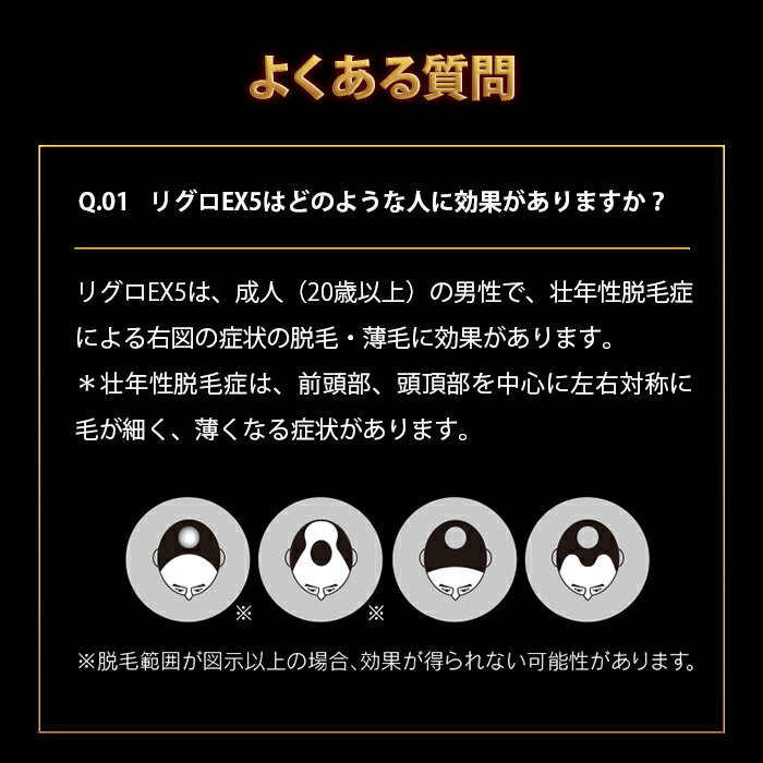 楽天市場 第1類医薬品 送料無料 ロート製薬公式 リグロex5 シャンプーセット ミノキシジル国内最大濃度5 配合 育毛剤 養毛剤 発毛剤 ミノキシジル 発毛 脱毛症 Aga 発毛促進 男性用 育毛 養毛 薄毛 抜け毛 薄毛対策 男性 頭皮 メンズ 抜け毛ケア 薄毛ケア 40代