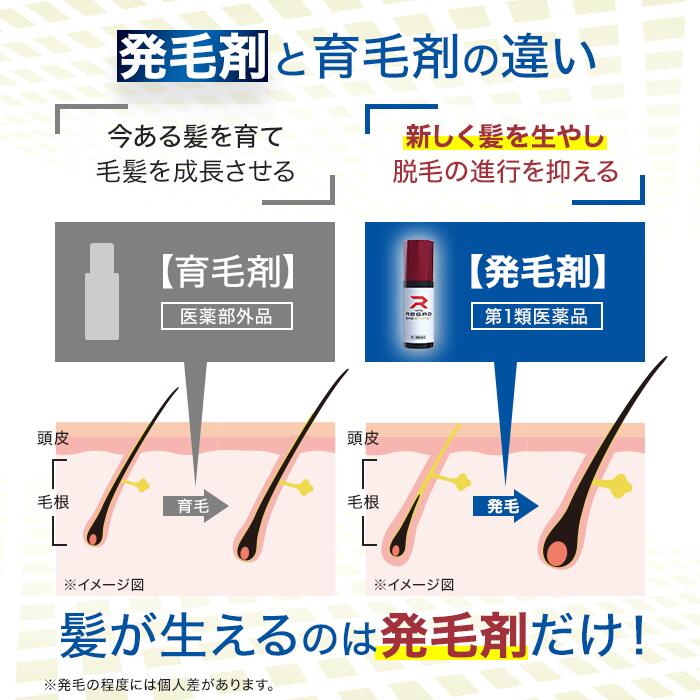 【第1類医薬品】ロート製薬公式 リグロEX5エナジー 60ml 発毛剤 ミノキシジル国内...