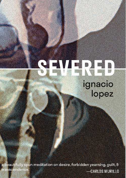 Severed - Ignacio Lopez (53rd State Press) 【紙書籍】 9781732545229