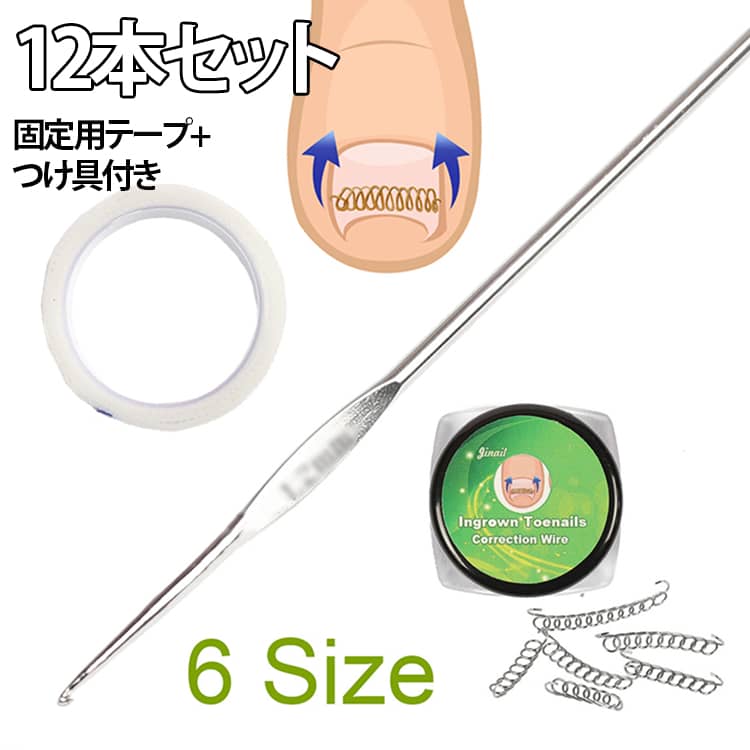 【痛くない】【自宅で巻き爪矯正】【12本セット】【固定用テープ+つけ具付き】自分で巻き爪のセルフ矯正！痛い巻き爪のお悩みに加工不要の巻き爪・陥入爪の矯正器具ですぐに使えます。普通・軽度巻き爪・中等巻き爪・重度巻き爪・片側巻き爪など、すべてのタイプの巻き爪に使用可能。●シャワー可能/移動可能 日常生活に支障をきたさない●洗えるので、いつでも清潔に保てます!●繰り返し使えて経済的、手入れも簡単! サイズ 固定用テープ+つけ具付き サイズについての説明 【セットの内容】矯正チエーン：2組セット（1組6本、共12本）　固定用テープ：1巻　つけ具：1本　【矯正チエーンのサイズ】12－15mm x 2本　14－17mm x 2本　16－20mm x 2本　18－22mm x 2本　20－24mm x 2本　22－26mm x 2本　【サイズ選択の目安】標準サイズ：16mm　男性(足の大きめの方)：14mm/16mm　女性(足の小さめの方)：16mm/18mm　※実際の爪表面の長さを参考にサイズ選定してください。迷った時は小さめが無難です※疼痛が片側の場合は小さめのサイズを選、ぶの無難です(片側に寄せで使用できます)※爪が厚い場合や変形が強い場合は小さめのサイズ選定が良いです(外側で急激に折れ曲 がっている爪を含む)※形状的には16mmサイズが標準的で使いやすいです。※各サイズで若干形状(波形状の角度)が変化します。 素材 ステンレス 色 12本セット（6サイズ） 備考 ●サイズ詳細等の測り方はスタッフ間で統一、徹底はしておりますが、実寸は商品によって若干の誤差(1cm～3cm )がある場合がございますので、予めご了承ください。 ●製造ロットにより、細部形状の違いや、同色でも色味に多少の誤差が生じます。 ●パッケージは改良のため予告なく仕様を変更する場合があります。 ▼商品の色は、撮影時の光や、お客様のモニターの色具合などにより、実際の商品と異なる場合がございます。あらかじめ、ご了承ください。 ▼生地の特性上、やや匂いが強く感じられるものもございます。数日のご使用や陰干しなどで気になる匂いはほとんど感じられなくなります。 ▼同じ商品でも生産時期により形やサイズ、カラーに多少の誤差が生じる場合もございます。 ▼他店舗でも在庫を共有して販売をしている為、受注後欠品となる場合もございます。予め、ご了承お願い申し上げます。 ▼出荷前に全て検品を行っておりますが、万が一商品に不具合があった場合は、お問い合わせフォームまたはメールよりご連絡頂けます様お願い申し上げます。速やかに対応致しますのでご安心ください。