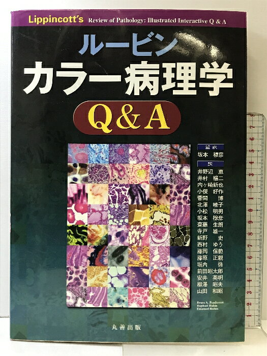 šۥ롼ӥ 顼Q&A  Bruce A. Fenderson
