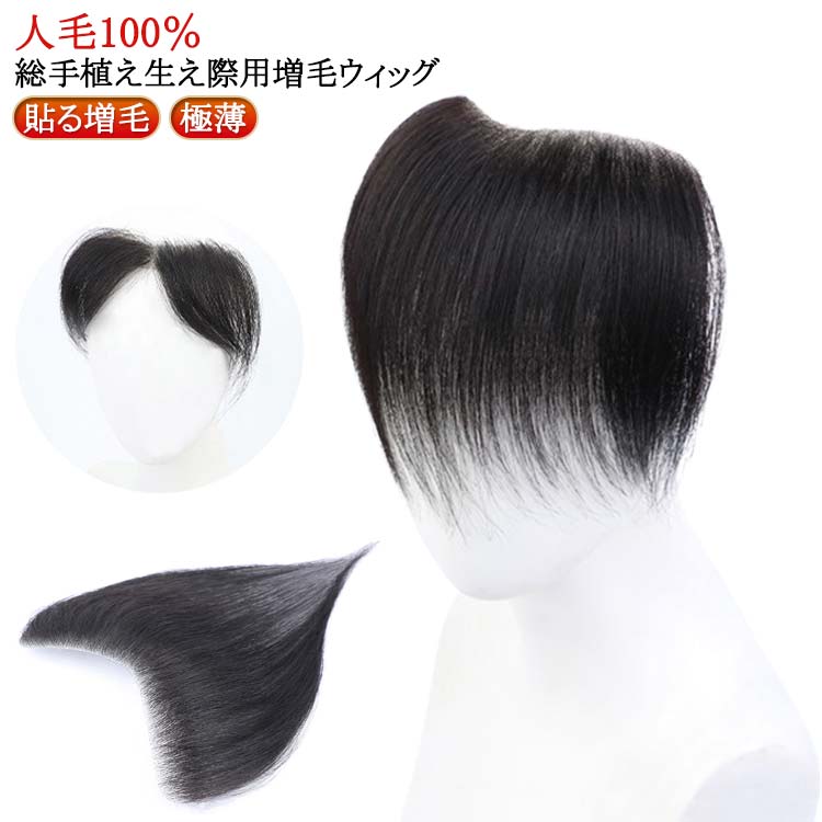 生え際 増毛 メンズ 男性用 増毛シート 生え際 シール 黒 貼る 生え際 M型 脱毛症 ポイントウィッグ 部分ウィッグ かつら シール式 脱毛