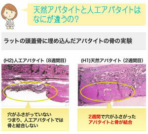【送料無料】キラルンペースト100gホワイトデー歯磨き粉ホワイトニング口臭予防口臭対策自宅歯みがき粉ハミガキ歯周病歯垢除去オーガニックハミガキ粉無添加ヤニ取り歯黄ばみクリーナー白く美白研磨剤【RCP】【HLS_DU】新生活