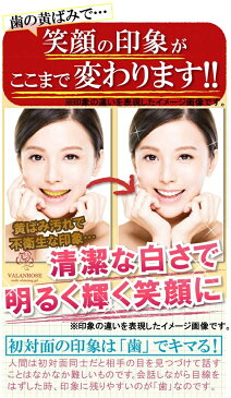 ドブ口臭⇒ホワイトローズが溢れ出す!!自宅で簡単♪輝く白い歯に!! バランローズ トゥースホワイトニングジェル(VALANROSE tooth whitening gel 30g 歯 歯みがき ジェル ホワイトニング デンタルケア)