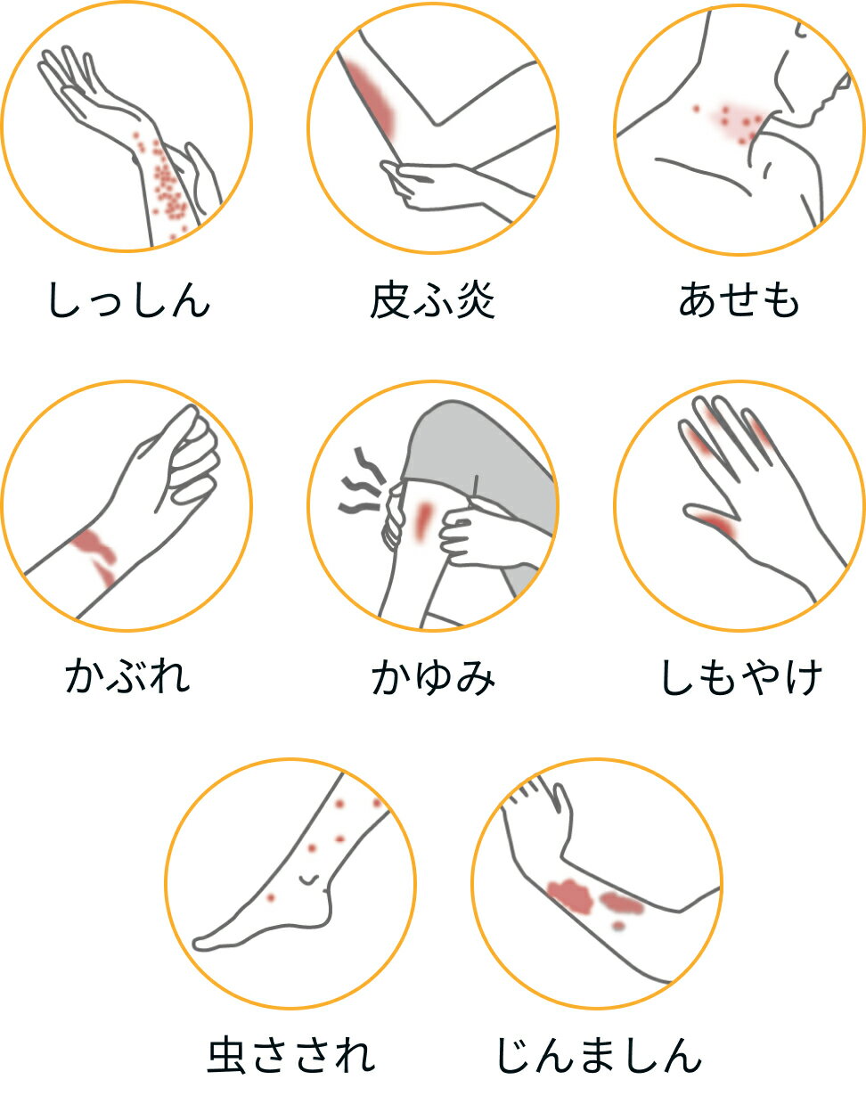 【第(2)類医薬品】リンデロンVsクリーム 10g×4個セット(セルフメディケーション税制対象)