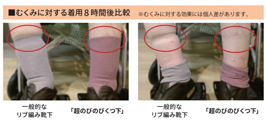 [エンゼル] 超のびのびくつ下 ハイソックスタイプ R-991 浮腫み ギプス 装具 ゆるい 伸びる 介護 高齢者 男性 紳士 メンズ 女性 婦人 レディース 共用 ANGEL