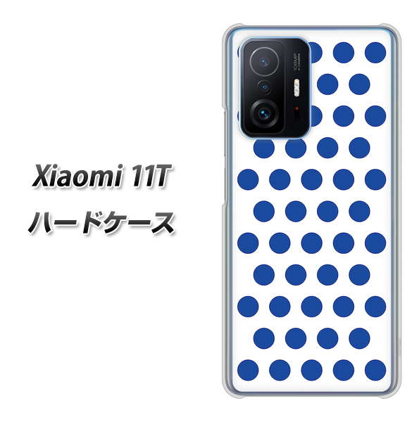 SIMt[ Xiaomi 11T n[hP[X / Jo[yVA915 hbg zCg~u[ fރNAz UV 𑜓x(VI~11T/XIAOMI11T/X}zP[X)