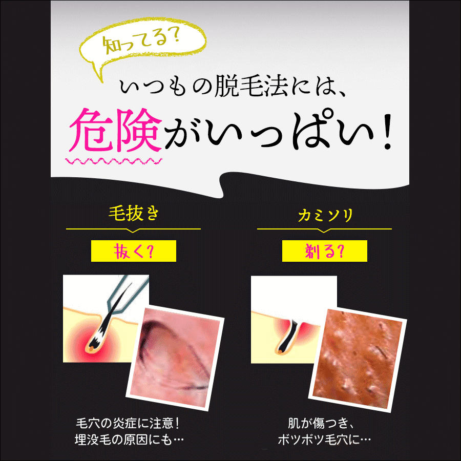 最短除毛クリーム 最速脱毛クリーム 5個 1個サービス計6個販売 ゼロクリーン クリーム 薬用除毛クリーム 除毛剤 除毛液 剛毛 一部予約 多毛 背毛 無駄毛 髭 産毛 脚毛 ムダ毛 毛深い 腹毛 医薬部外品 腕毛 ヘアケア 男子女子 Vゾーン スッキリ除毛 スネ毛 ヘアーケア ワキ毛 最短除毛クリーム 最速脱毛クリーム 5個 1個サービス計6個販売 ゼロクリーン クリーム 薬用除毛クリーム 除毛剤 除毛液 剛毛 一部予約 多毛 背毛 無駄毛 髭 産毛 脚毛 ムダ毛 毛深い 腹毛 医薬部外品 腕毛 ヘアケア 男子女子 Vゾーン スッキリ除毛 スネ毛 ヘアーケア ワキ毛