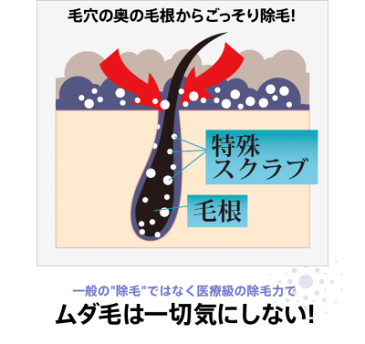 ■■【ミクロクリスタ スクラブインバスリムーバー】剛毛・うぶ毛・すね毛・ワキ毛・腕毛・足毛…最短1分除毛!最新除毛剤です。