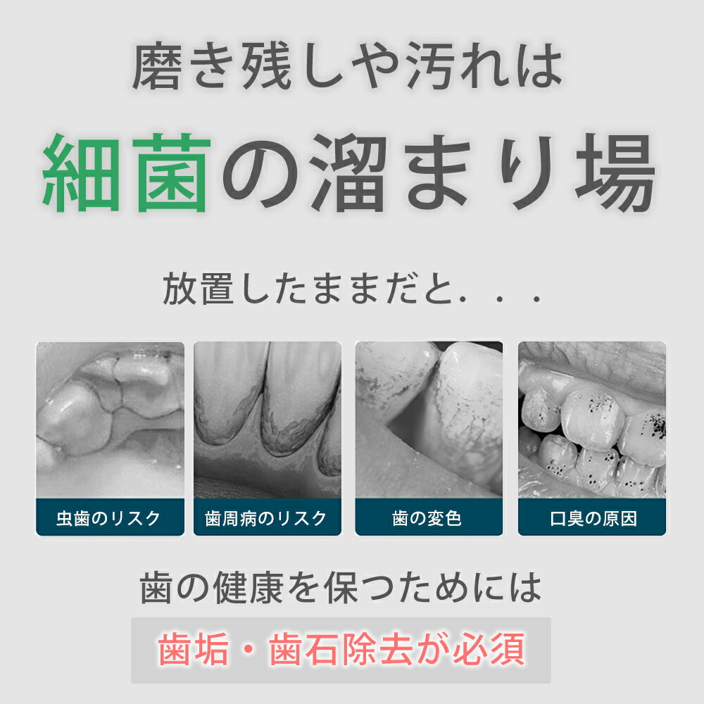 【クーポンで3,000円→2,700円!】歯石...の紹介画像3