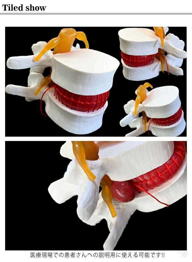 腰椎間板 模型 腰椎模型 骨盤 骨格模型 骨模型 骸骨模型 人体模型 骨格標本 骨格 標本 12cm 教材 実験 接骨院 整骨院 モデル ガイコツ 間接模型 人骨模型 骨 ガイコツ 3