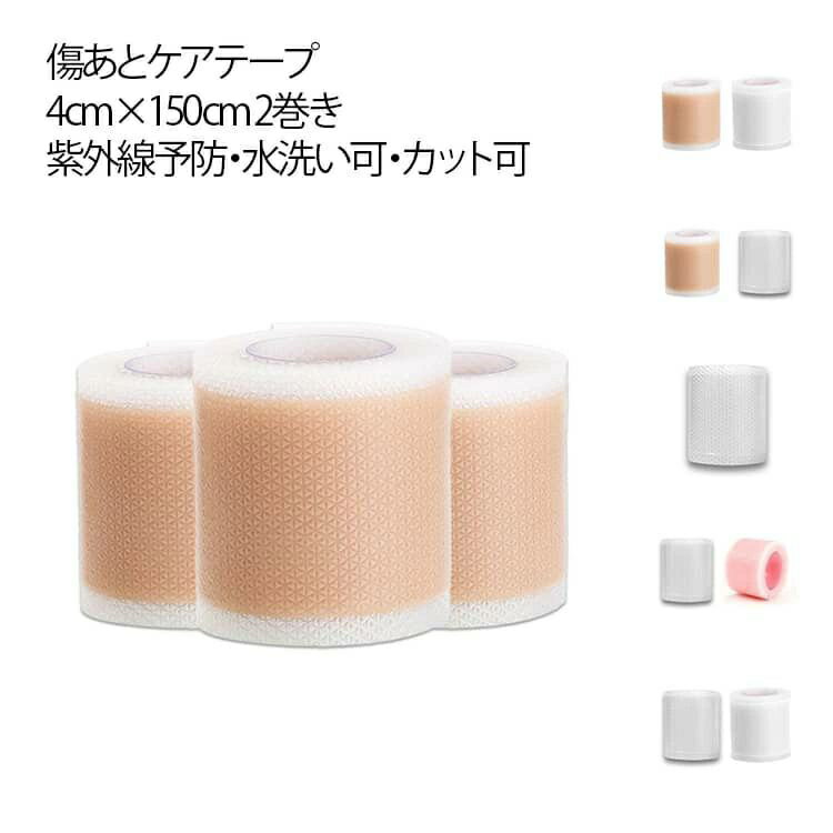 傷あとケアテープ 帝王切開 傷跡ケアテープ 傷あとケア用 シリコンジェルシート シリコンテープ 傷テープ テープ 貼り心地にもこだわった 帝王切開 ケロイド 傷隠し 保護テープ 傷あとケアテープ ケロイド 4cm×150cm 紫外線カット 繰り返し使える 水洗い可