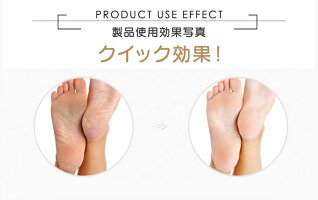 楽天市場 最新モデル 角質除去 かかと磨き かかと削り ひび割れ フットケア グッズ グラインダー 電動やすり 電動ヤスリ 電動 かかと かかとケア 自宅 足裏 角質ケア かかとヤスリ リムーバー かかとツルツル 送料無料 Cran 楽天市場店 楽天市場 最新モデル 角質除去 かかと磨き かかと削り ひび割れ フットケア グッズ グラインダー 電動やすり 電動ヤスリ 電動 かかと かかとケア 自宅 足裏 角質ケア かかとヤスリ リムーバー かかとツルツル 送料無料 Cran 楽天市場店