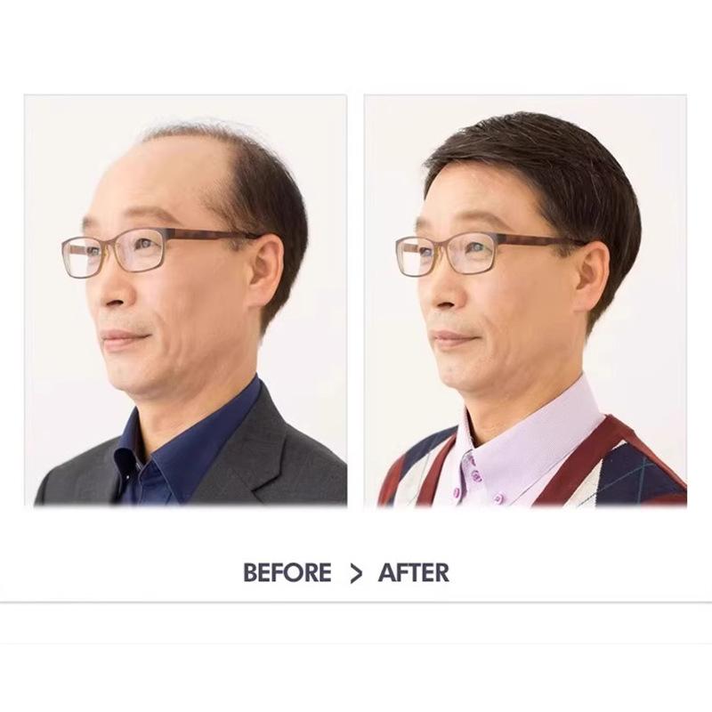 メンズウィッグ 男性用 人毛100% 全頭かつら ヘアピース 医療用 短髪 黒髪 遮 ক্যাপ付き 自然 通気性 ショート 斜め前髪