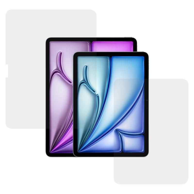 Amazonブランド】CRYSTAL VIEW Professional Grade