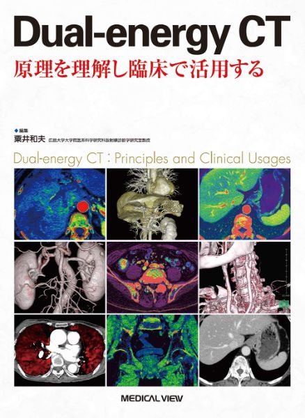 Dual－energy CT ／ メジカルビュー社