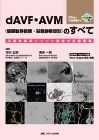 DAVF・AVM(硬膜動静脈瘻・脳動静脈奇形)のすべて / メディカ出版
