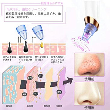 2020年改良版 毛穴吸引器 MADOT スポットクリア 角栓吸引器 美顔器 黒ずみ吸出 毛穴クリーン フェイスケア イチゴ鼻 ニキビ たるみ改善 しわ取り 5種類の吸引ヘッド 吸引力3段階調整 USB充電式 日本語説明書付き