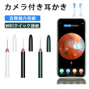 耳内視鏡 耳垢除去キット インテリジェントワイヤレス可視耳鏡 WiFiイヤークリーナーカメラ 大人 子供 ペット耳かき カメラ付き LED イヤースコープ 無線...