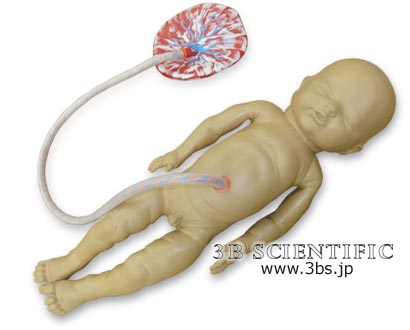 【送料無料】【無料健康相談付】世界基準 3Bサイエンフィティック社吸引出産用胎児モデル(W45025用) 人体模型