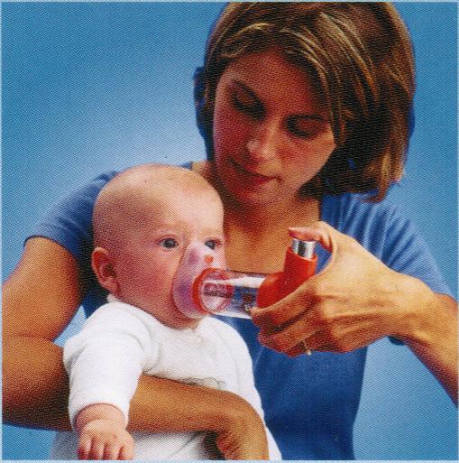 エアロチャンバープラス MDI用スペーサー マスク付き乳児用(0~18ヶ月)