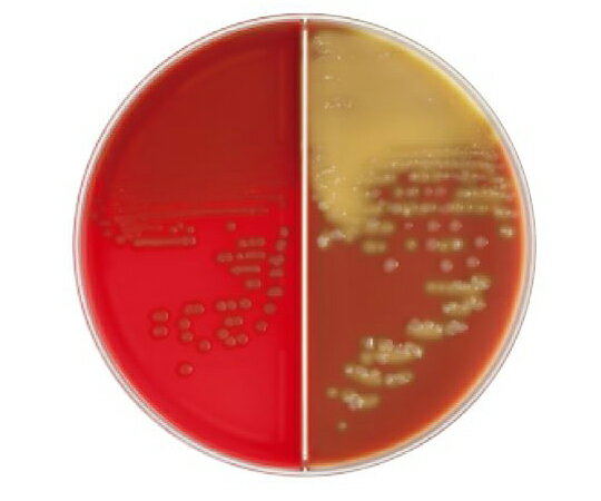 ベクトン・ディッキンソン BD BBL(TM) TSA5%ヒツジ血液寒天培地/チョコレート寒天培地 LDIP 100枚 1個(1本×100枚入) 251416