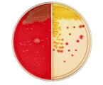 ベクトン・ディッキンソン BD BBL（TM） TSA5％ヒツジ血液寒天培地/DHL寒天培地 100枚 1個(1本×100枚入) 252022