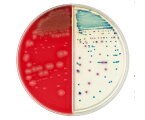 ベクトン・ディッキンソン BD BBL（TM） TSA5％ヒツジ血液寒天培地/CHROMagar（TM） オリエンテーション寒天培地 100枚 1個(1本×100枚入) 252075