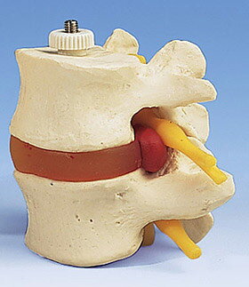 3B社　腰椎模型 腰椎2交連モデル (a76-9) 人体模型