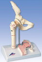 【送料無料】3B社　病理学模型　大腿骨骨折モデル　（a88) 人体模型