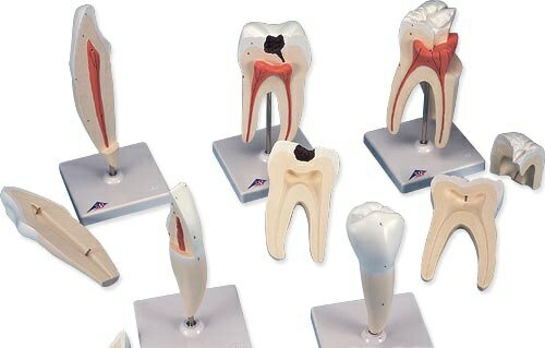 【送料無料】【無料健康相談 対象製品】3B社　歯模型 歯のシリーズ8倍大モデルセット (d10) 人体模型